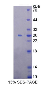 Metaxin 1蛋白(MTX1)重组蛋白