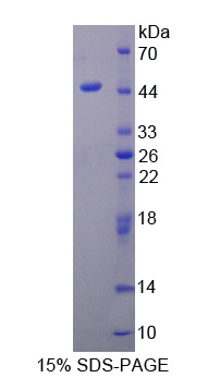 Mg2+/Mn2+依赖性蛋白磷酸酶1A(PPM1A)重组蛋白
