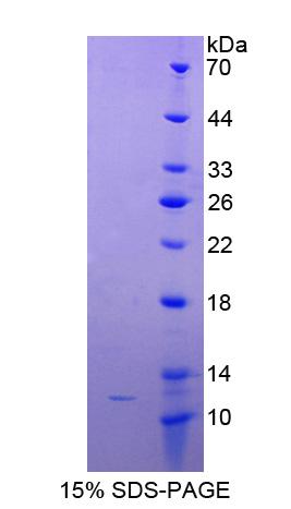 MYC关联因子X(MAX)重组蛋白