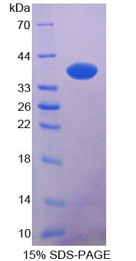 N-myc下游调节基因2(NDRG2)重组蛋白