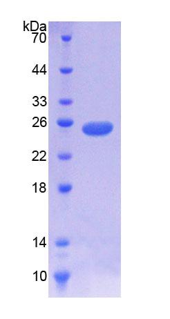 NODAL调节因子1(NOMO1)重组蛋白