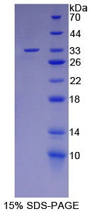NUAK家族SNF1样激酶1(NUAK1)重组蛋白