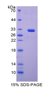 p21蛋白激活激酶1(PAK1)重组蛋白