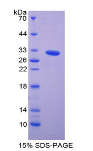 p21蛋白激活激酶2(PAK2)重组蛋白