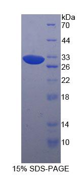 p21蛋白激活激酶4(PAK4)重组蛋白