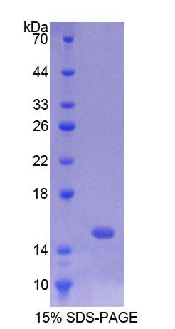 p53上调凋亡调节因子(PUMA)重组蛋白