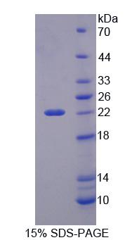 PHD指蛋白8(PHF8)重组蛋白