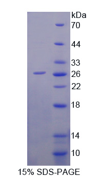 Pim-2原癌基因(PIM2)重组蛋白