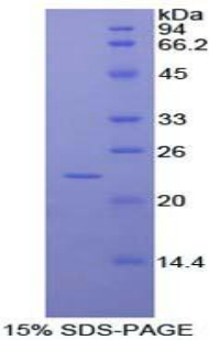 RAD54样蛋白2(RAD54L2)重组蛋白