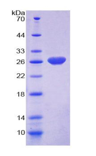 Ras GTP酶激活蛋白1(RASA1)重组蛋白