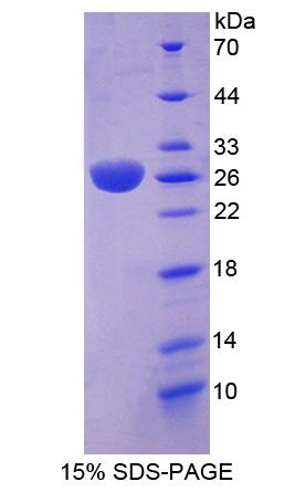 RAS癌基因家族成员RAB37(RAB37)重组蛋白