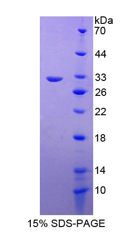 RAS癌基因家族成员RAB5A(RAB5A)重组蛋白