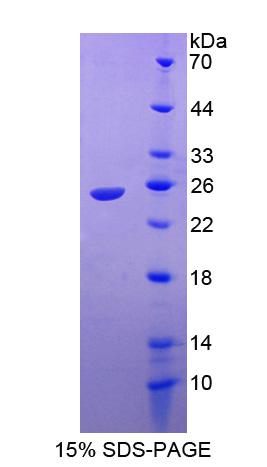 Ras相关C3肉毒菌毒素底物1(Rac1)重组蛋白