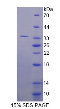 Ras抑制蛋白1(RSU1)重组蛋白