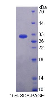 Rhotekin蛋白(RTKN)重组蛋白