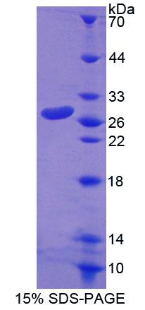 Rho家族GTP酶1(RND1)重组蛋白