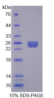 Rho鸟嘌呤核苷酸交换因子7(ARHGEF7)重组蛋白
