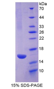 R-脊椎蛋白1(RSPO1)重组蛋白