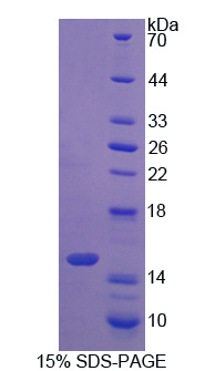 S100钙结合蛋白A16(S100A16)重组蛋白