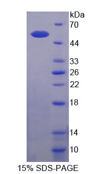 Sestrin 1蛋白(SESN1)重组蛋白