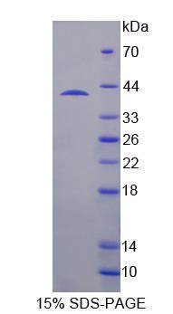 SH3域结合蛋白2(SH3BP2)重组蛋白