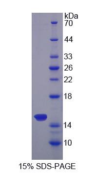 Sideroflexin 1蛋白(SFXN1)重组蛋白