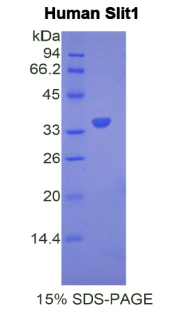 Slit同源物1(Slit1)重组蛋白