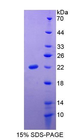 Slit同源物3(Slit3)重组蛋白