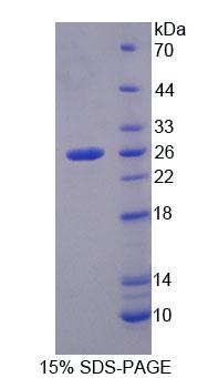 Smad同源物2(Smad2)重组蛋白