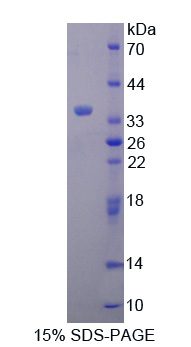 TAK1样蛋白(TAK1L)重组蛋白
