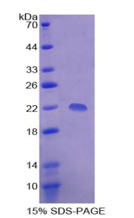 TBP结合转录向下调节因子1(DR1)重组蛋白