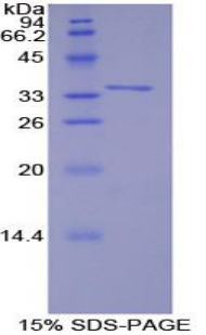 TNF受体关联因子6(TRAF6)重组蛋白