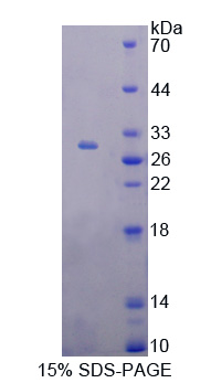 T-框蛋白21(TBX21)重组蛋白
