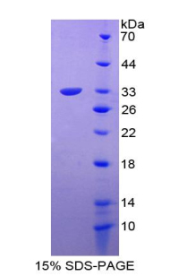 T-框蛋白4(TBX4)重组蛋白