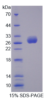 UL16结合蛋白2(ULBP2)重组蛋白