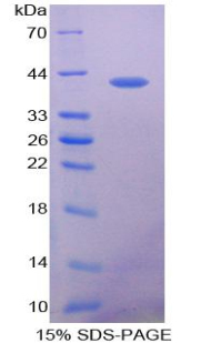 VEGF共调节趋化因子1(VCC1)重组蛋白