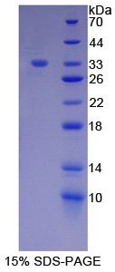 V-Erb B2红白血病病毒癌基因同源物3(ErbB3)重组蛋白