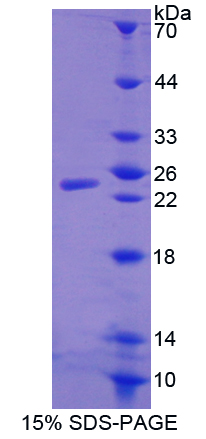 WAP四二硫化物核心域蛋白1(WFDC1)重组蛋白