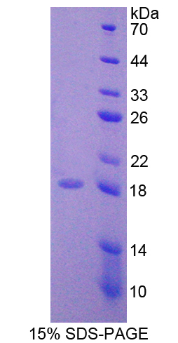 WNT1诱导信号通道蛋白1(WISP1)重组蛋白