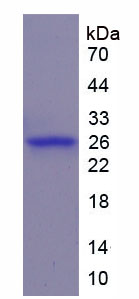 WNT1诱导信号通道蛋白2(WISP2)重组蛋白