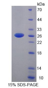 YY1关联因子2(YAF2)重组蛋白