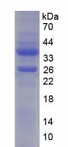 Y-框结合蛋白1(YBX1)重组蛋白