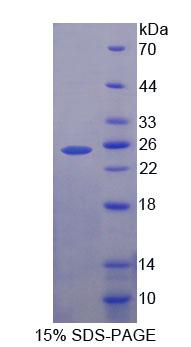 Zeste同源物增强子1(EZH1)重组蛋白