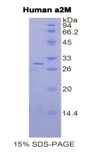 α2-巨球蛋白(a2M)重组蛋白