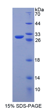 八聚体结合转录因子4(OCT4)重组蛋白