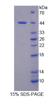 白介素12B(IL12B)重组蛋白