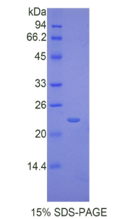 白介素17受体B(IL17RB)重组蛋白