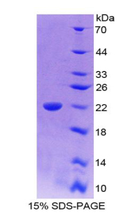 白介素18(IL18)重组蛋白