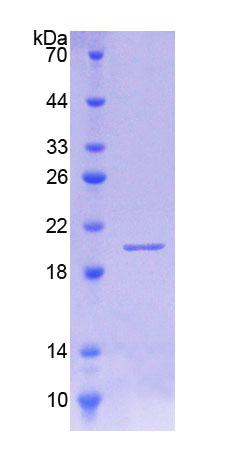 白介素18结合蛋白(IL18BP)重组蛋白