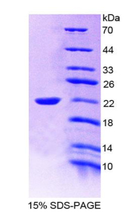 白介素19(IL19)重组蛋白